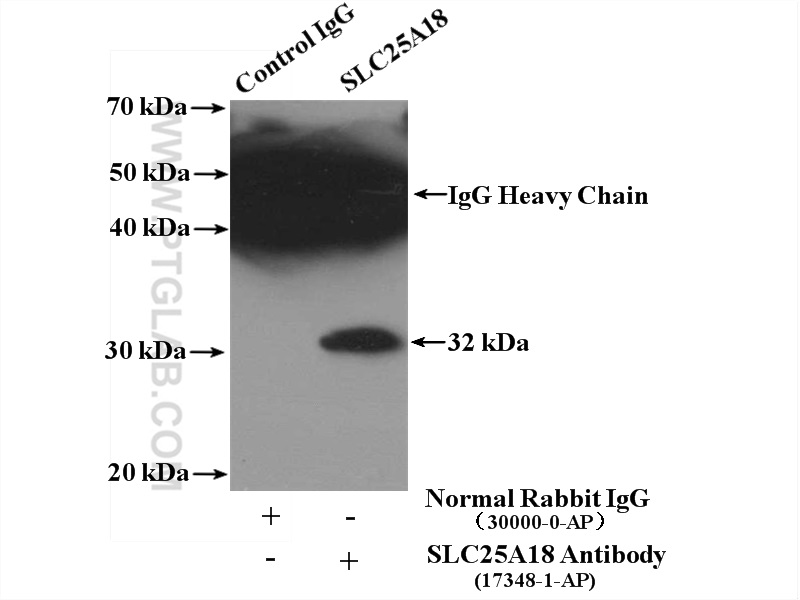 IP experiment of mouse brain using 17348-1-AP