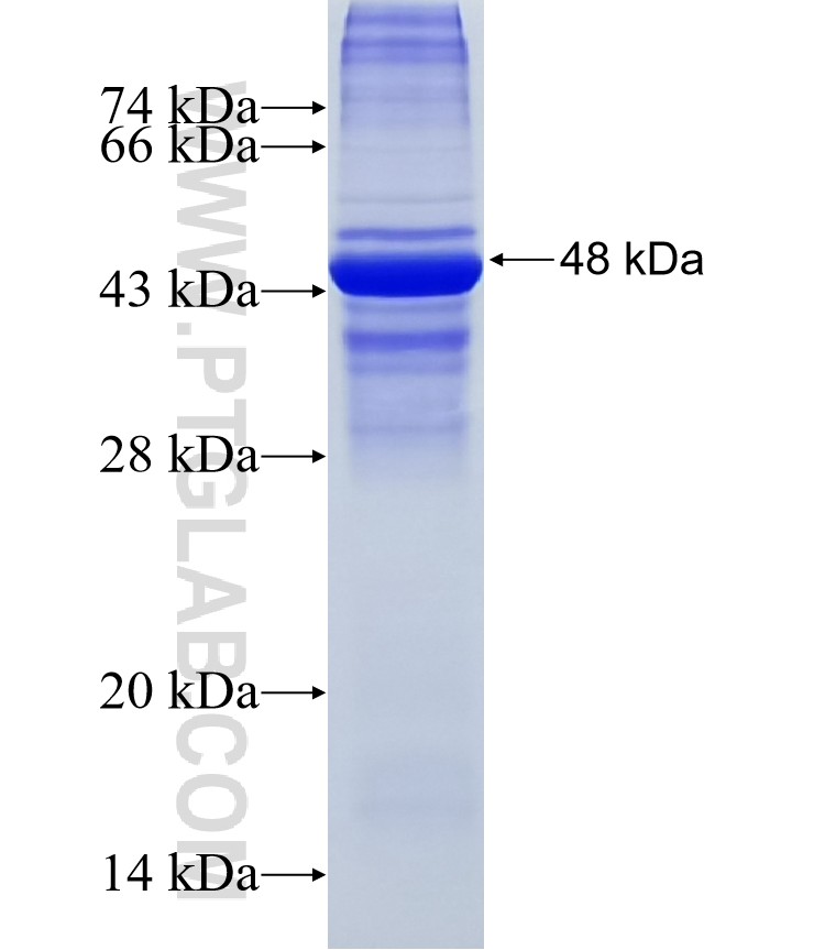 SLC25A18 fusion protein Ag11420 SDS-PAGE