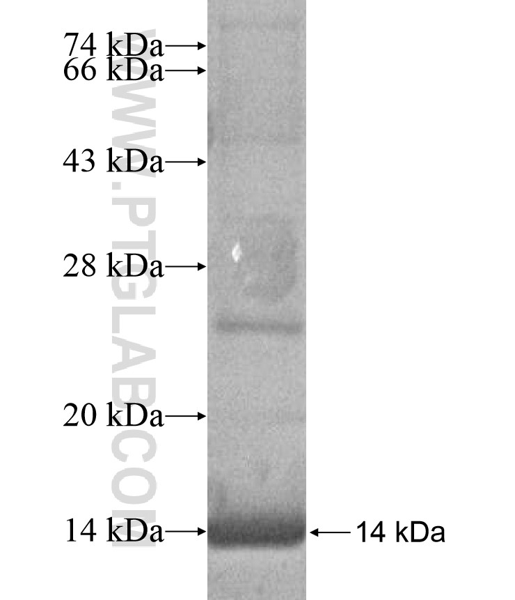 SLC25A2 fusion protein Ag17252 SDS-PAGE SLC25A2 fusion protein Ag17252 SDS-PAGE