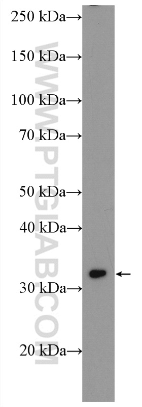 WB analysis of mouse heart using 19363-1-AP