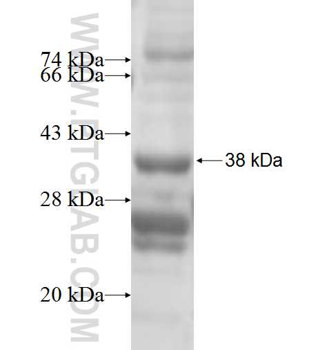 SLC25A20 fusion protein Ag6887 SDS-PAGE