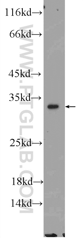 SLC25A22