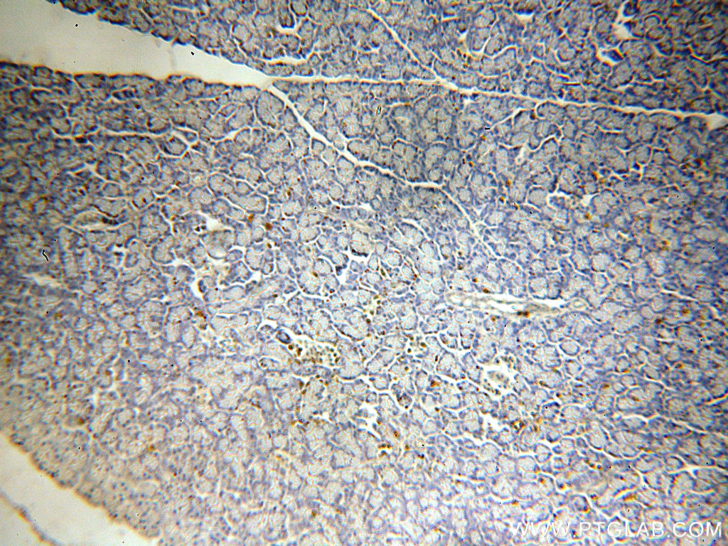 IHC staining of human pancreas using 20168-1-AP