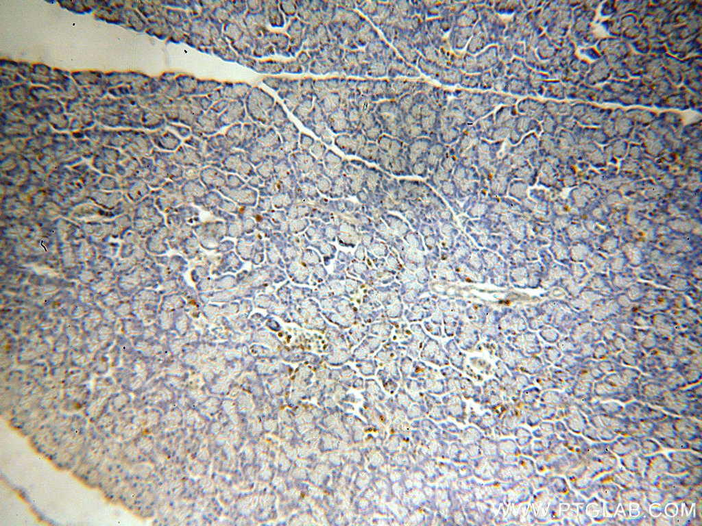 IHC staining of human pancreas using 20168-1-AP