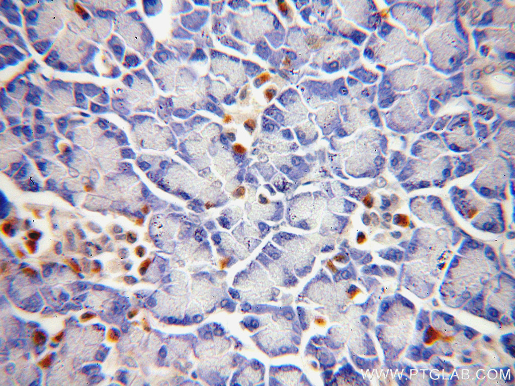 IHC staining of human pancreas using 20168-1-AP