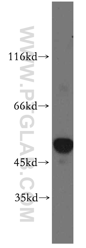 WB analysis of mouse pancreas using 20168-1-AP