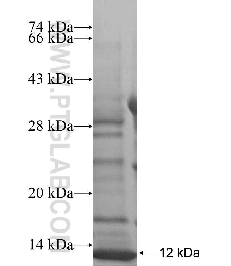 SLC25A25 fusion protein Ag17338 SDS-PAGE SLC25A25 fusion protein Ag17338 SDS-PAGE