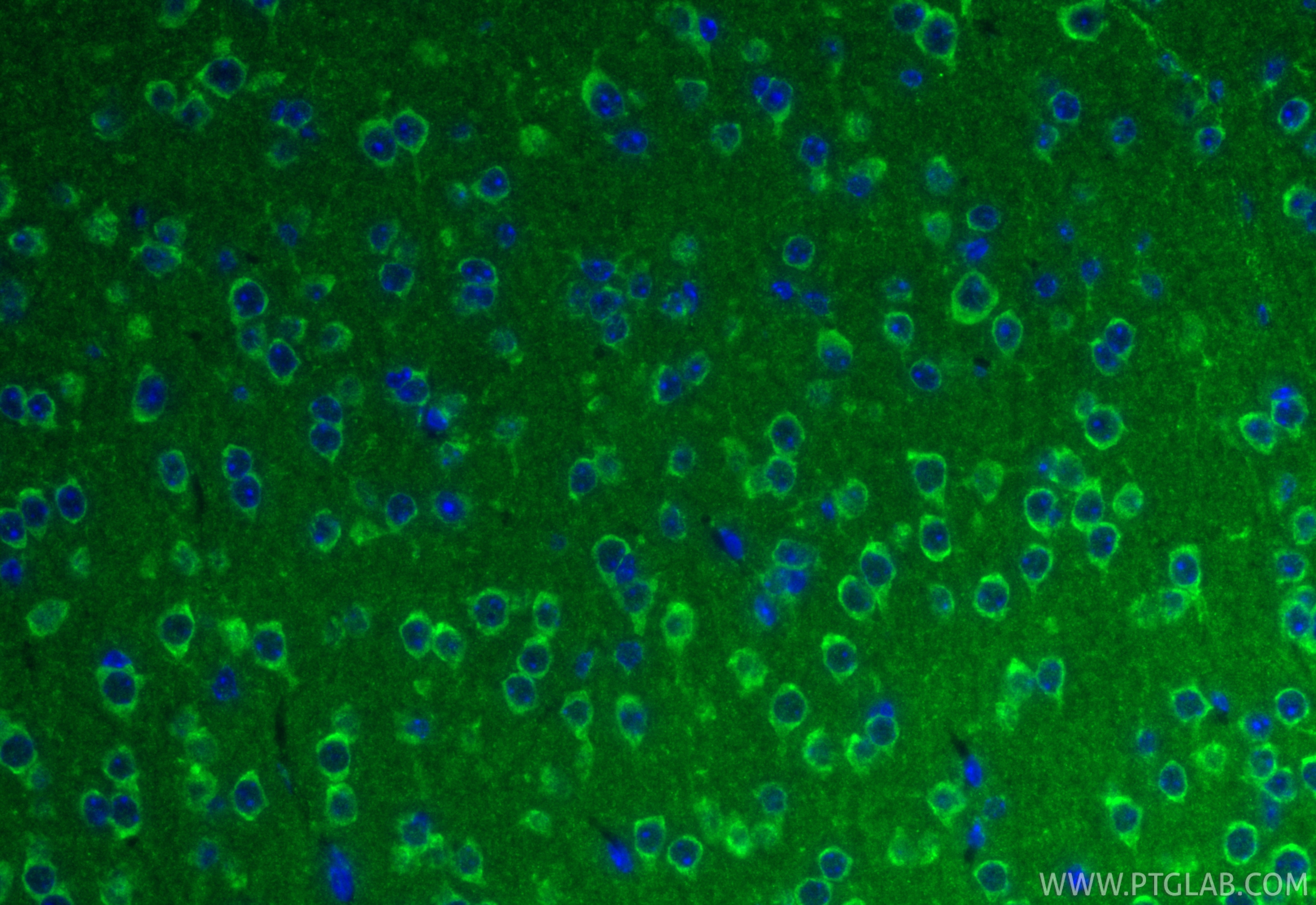 IF Staining of mouse brain using 26663-1-AP IF Staining of mouse brain using 26663-1-AP