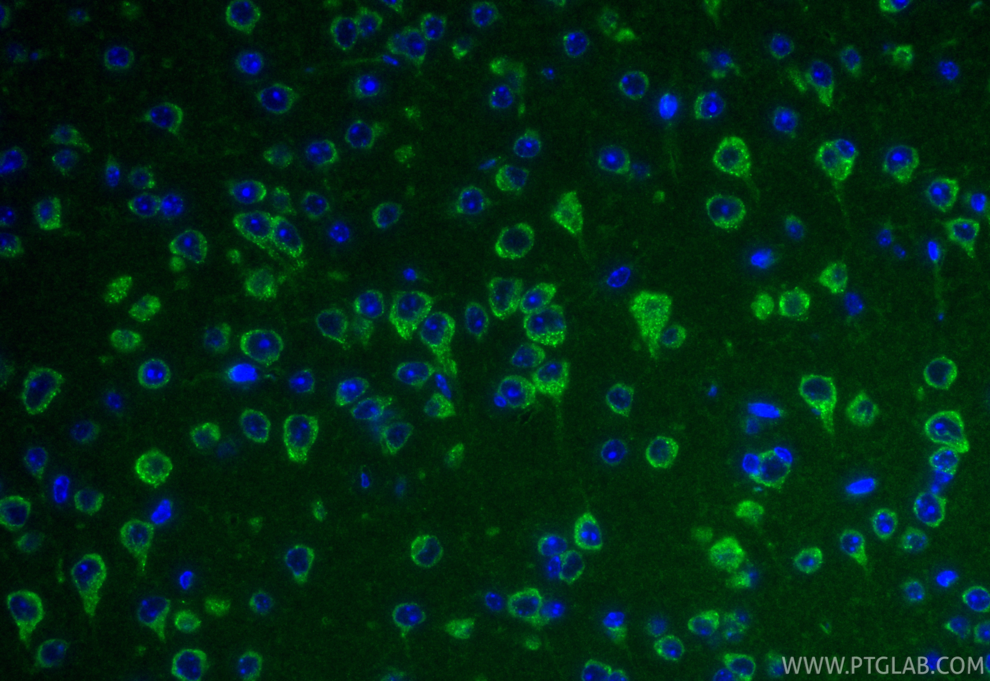 IF Staining of mouse brain using 87551-1-RR (same clone as 87551-1-PBS) IF Staining of mouse brain using 87551-1-RR (same clone as 87551-1-PBS)