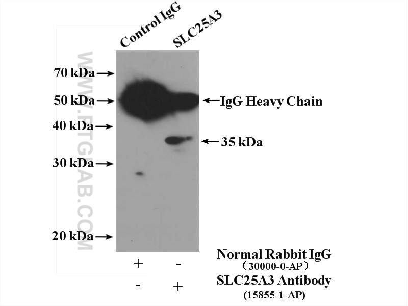 IP experiment of mouse heart using 15855-1-AP