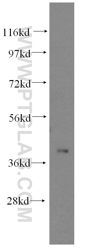 WB analysis of mouse pancreas using 15855-1-AP