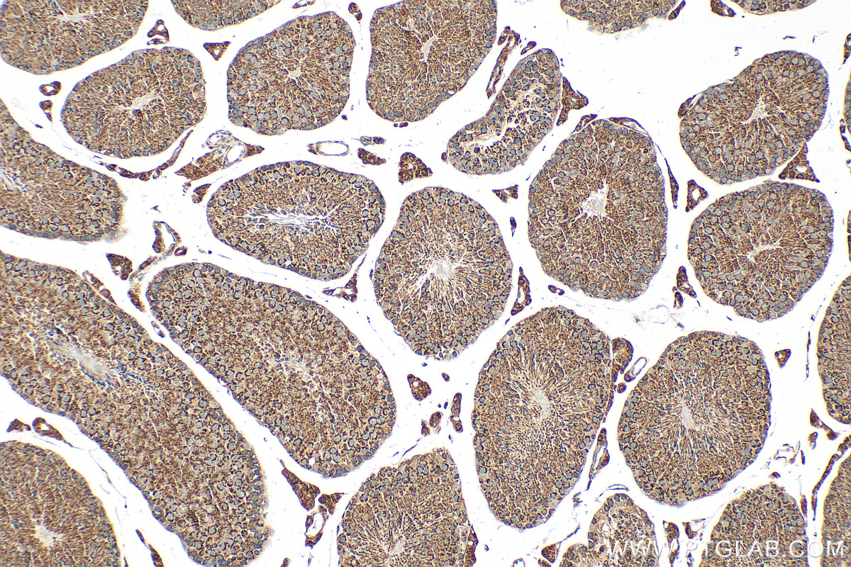 IHC staining of mouse testis using 33263-1-AP