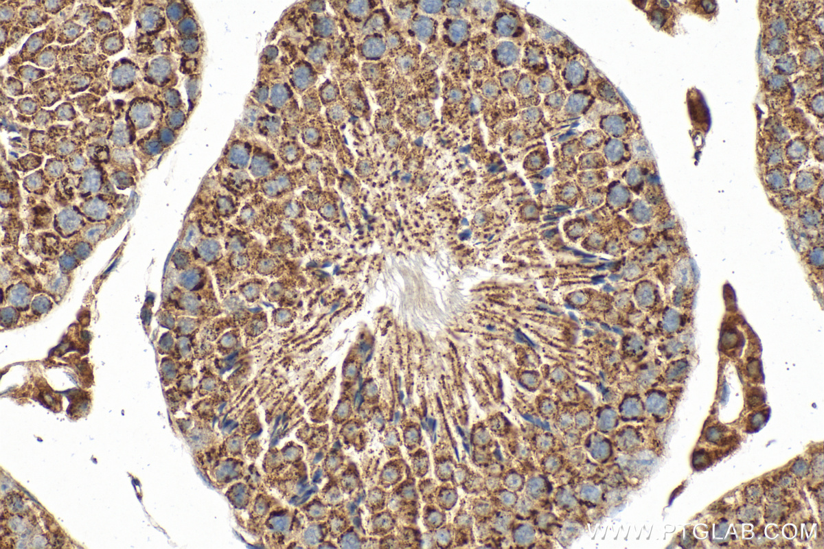 IHC staining of mouse testis using 33263-1-AP