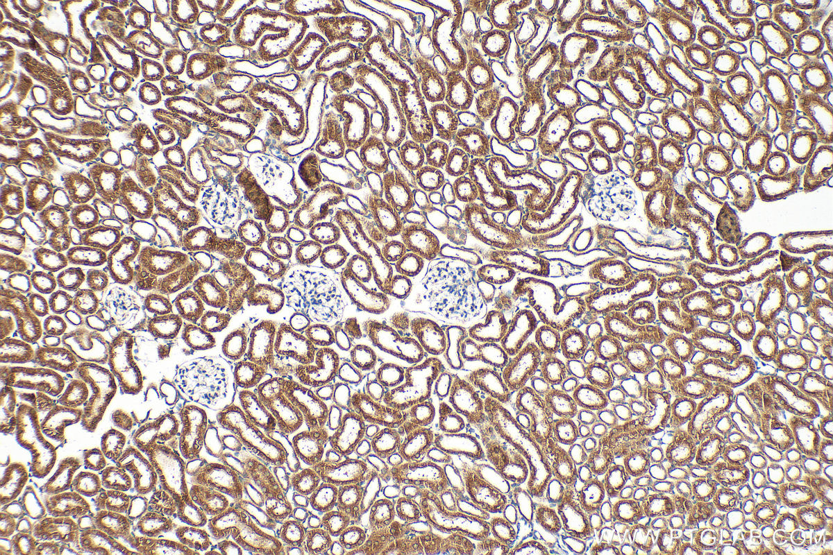 IHC staining of mouse kidney using 33263-1-AP