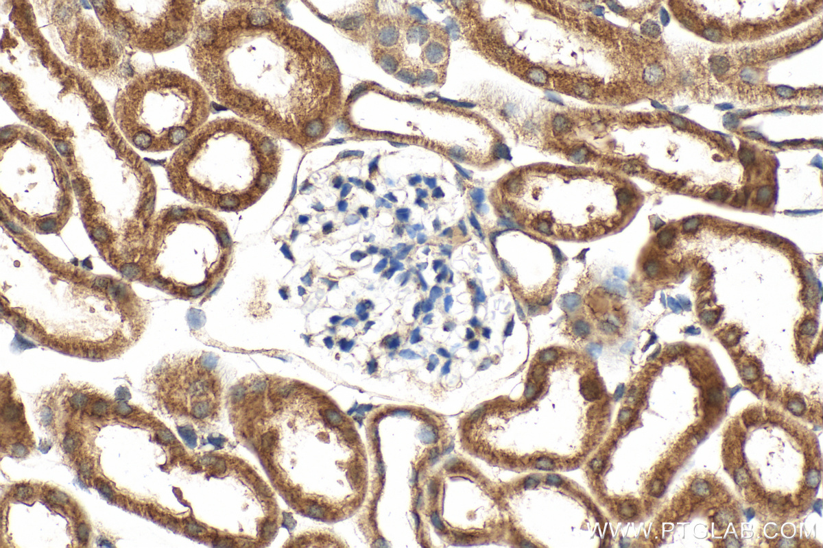 IHC staining of mouse kidney using 33263-1-AP