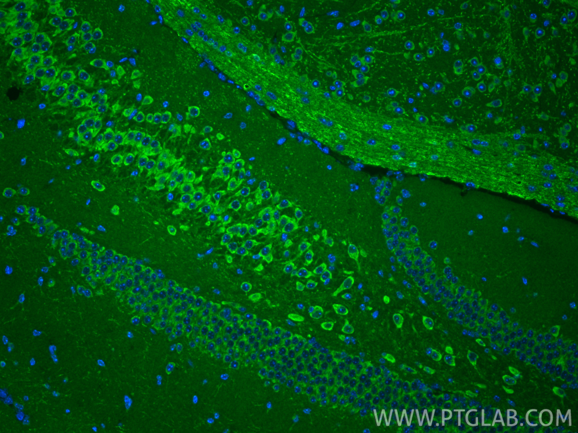 IF Staining of mouse brain using 13080-1-AP IF Staining of mouse brain using 13080-1-AP