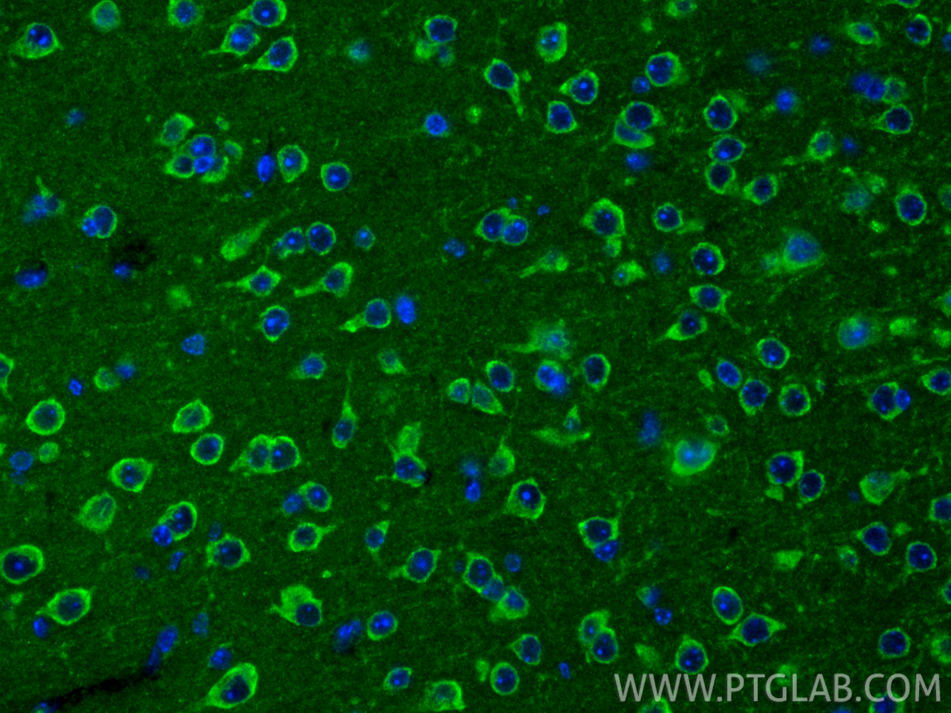 IF Staining of mouse brain using 13080-1-AP IF Staining of mouse brain using 13080-1-AP