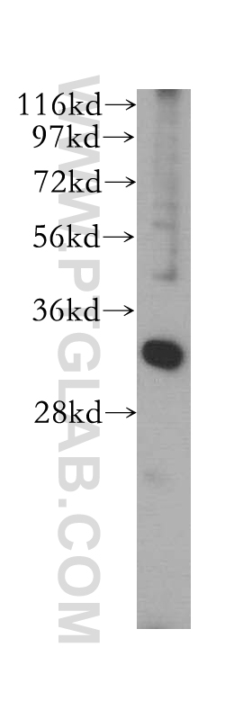 WB analysis of HepG2 using 17557-1-AP