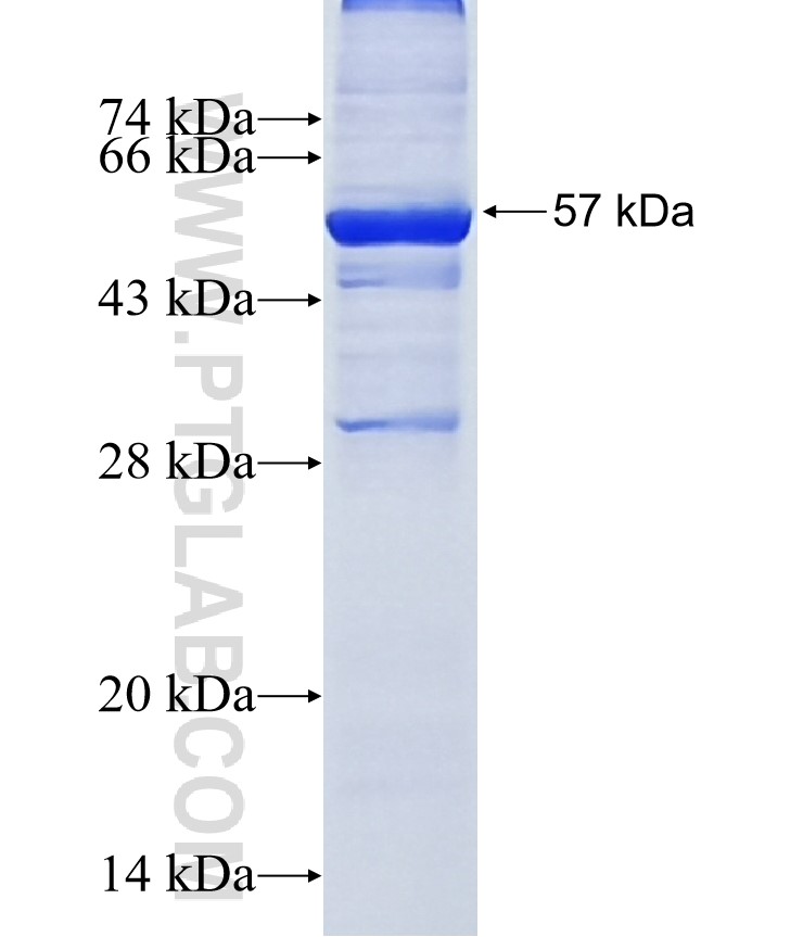 SLC25A34 fusion protein Ag11719 SDS-PAGE