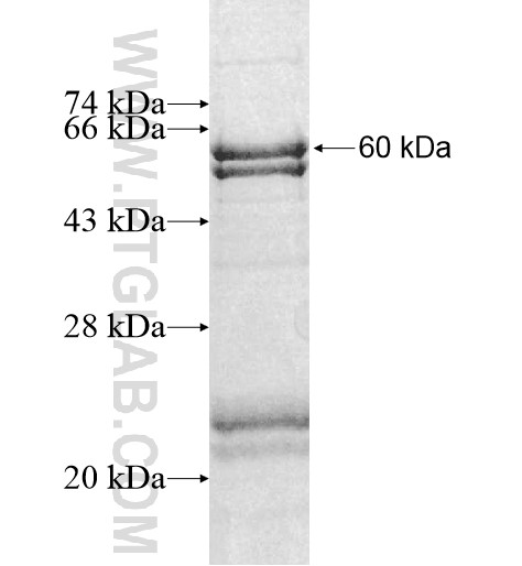 SLC25A38 fusion protein Ag10560 SDS-PAGE