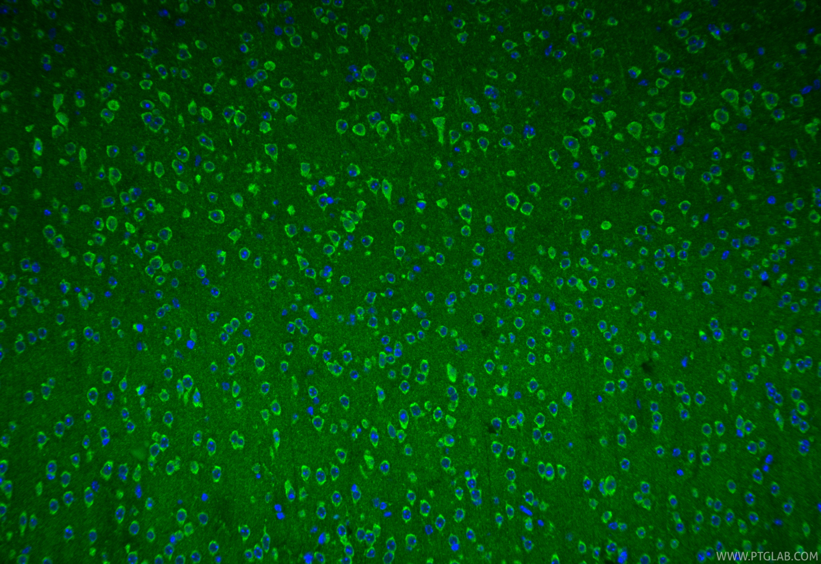 IF Staining of mouse brain using 17437-1-AP IF Staining of mouse brain using 17437-1-AP