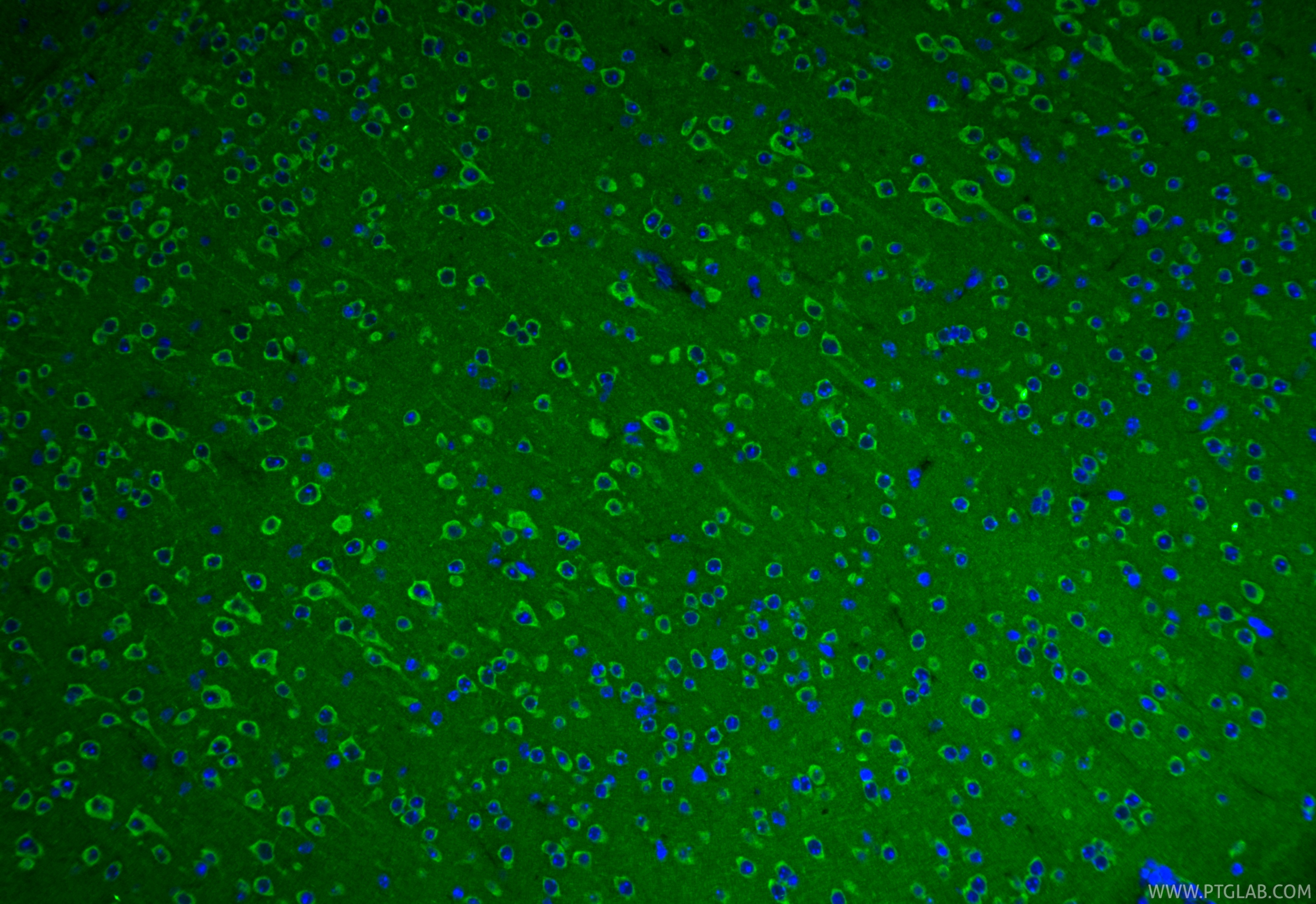 IF Staining of mouse brain using 27720-1-AP IF Staining of mouse brain using 27720-1-AP
