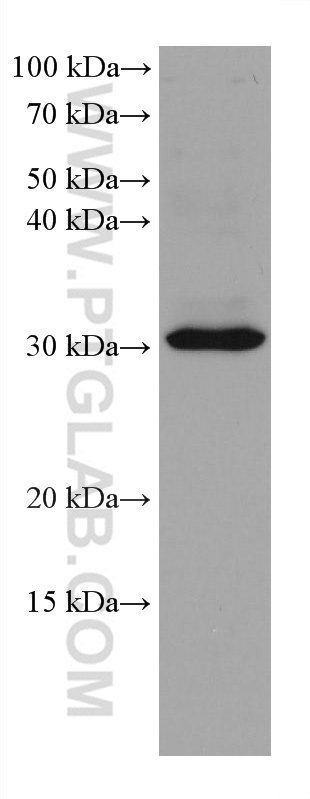 WB analysis of K-562 using 67819-1-Ig