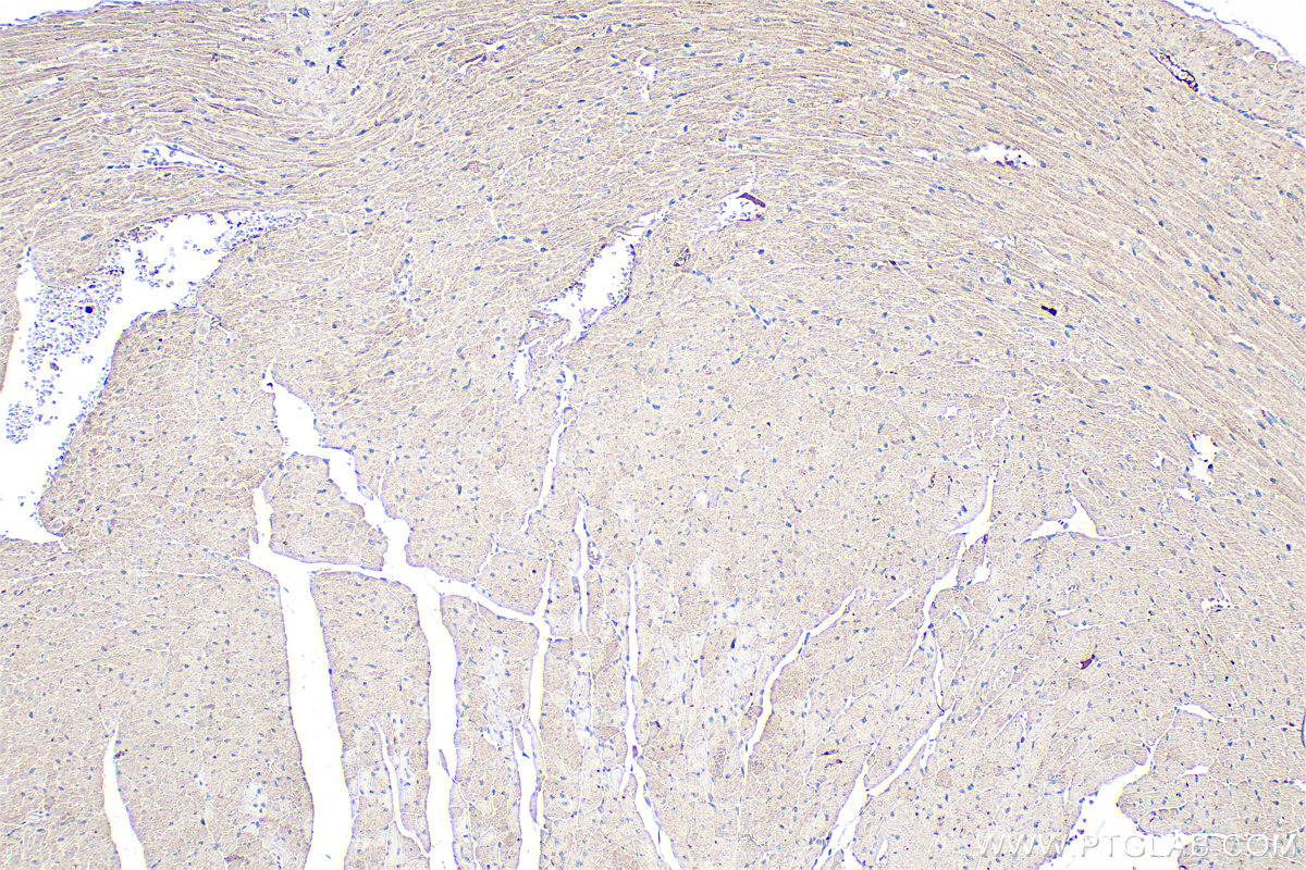 IHC staining of mouse heart using 17540-1-AP