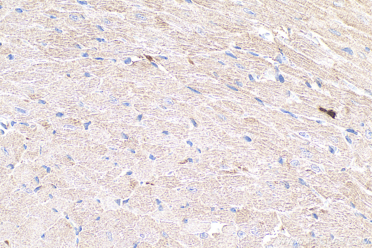 IHC staining of mouse heart using 17540-1-AP