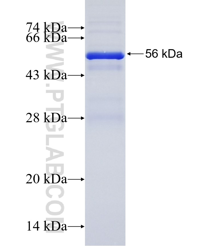 SLC25A44 fusion protein Ag11595 SDS-PAGE SLC25A44 fusion protein Ag11595 SDS-PAGE