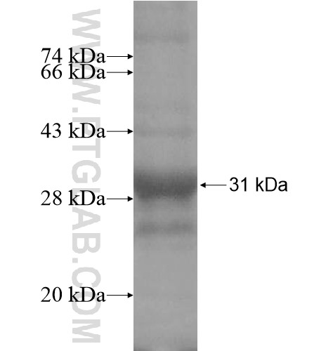 SLC25A44 fusion protein Ag11616 SDS-PAGE SLC25A44 fusion protein Ag11616 SDS-PAGE