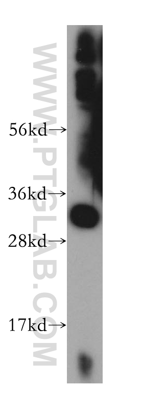 WB analysis of mouse skeletal muscle using 14160-1-AP