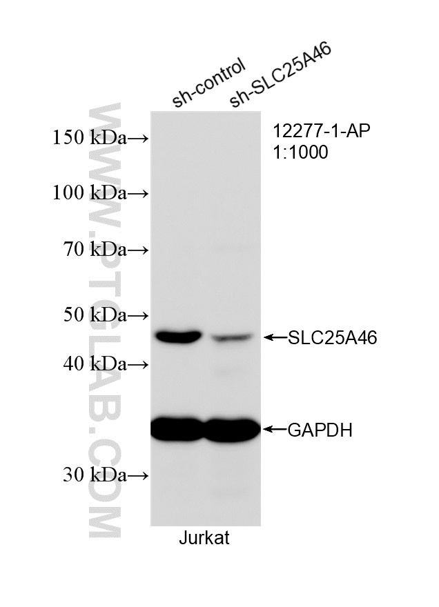 WB result of SLC25A46 antibody (12277-1-AP; 1:1000; incubated at room temperature for 1.5 hours) with sh-Control and sh-SLC25A46 transfected Jurkat cells. WB analysis of Jurkat using 12277-1-AP