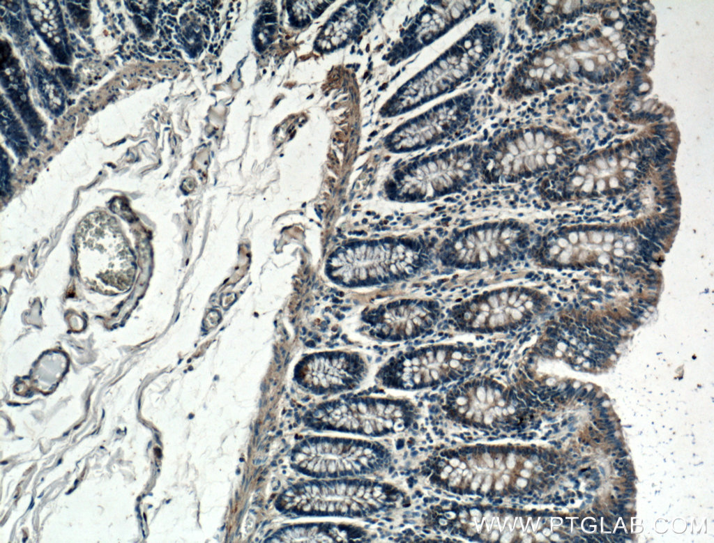 IHC staining of human colon using 27869-1-AP