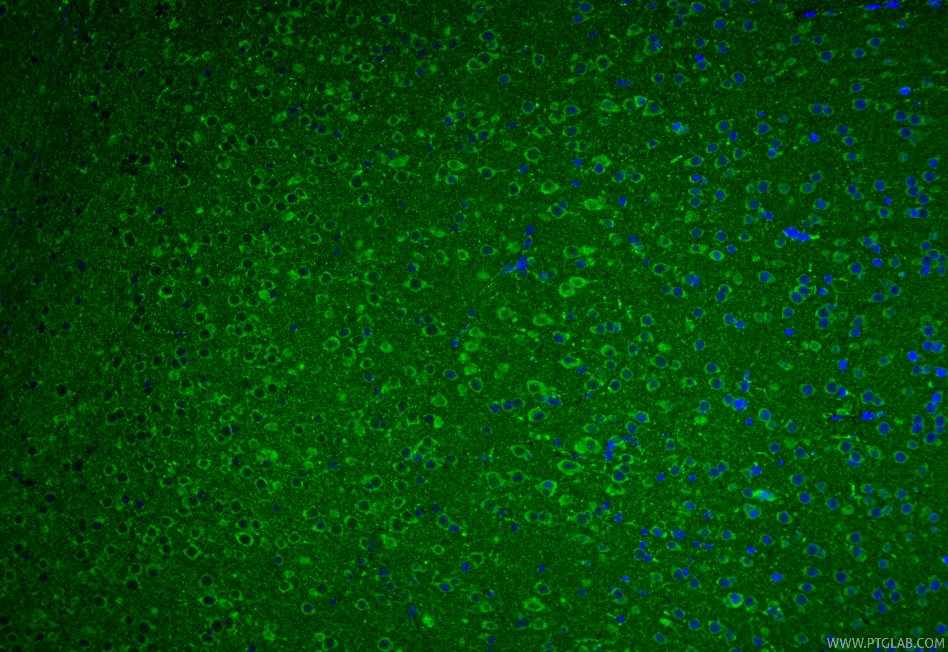 IF Staining of mouse brain using 17796-1-AP