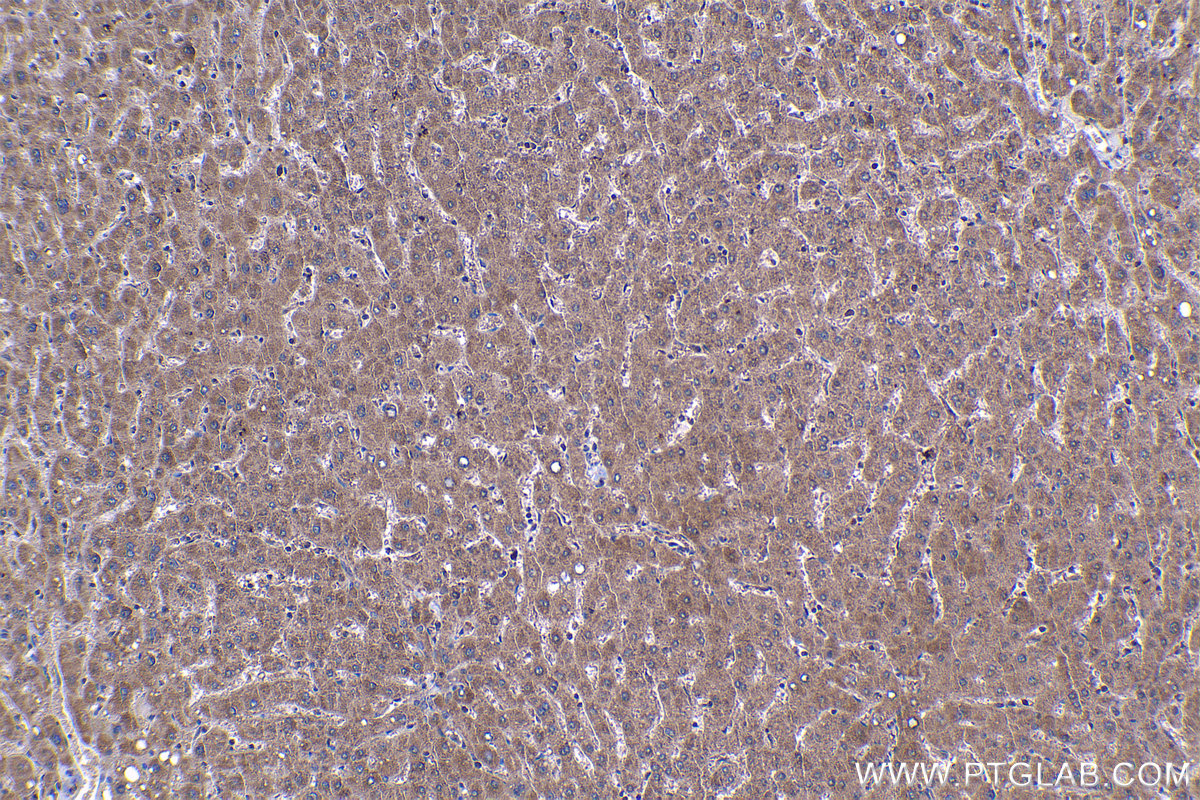 IHC staining of human liver using 17796-1-AP