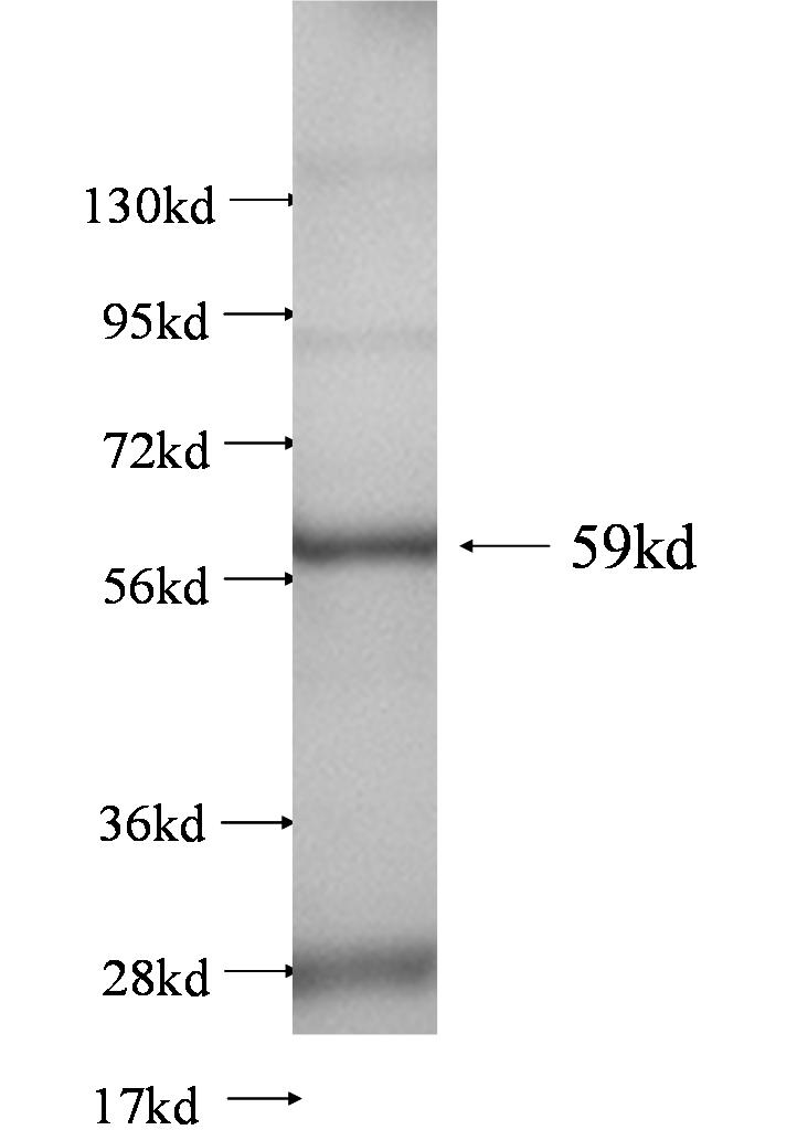 SLC25A6 fusion protein Ag0620 SDS-PAGE SLC25A6 fusion protein Ag0620 SDS-PAGE