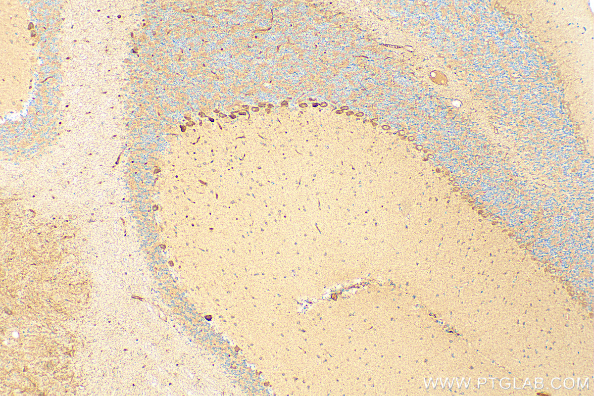 IHC staining of mouse cerebellum using 14156-1-AP
