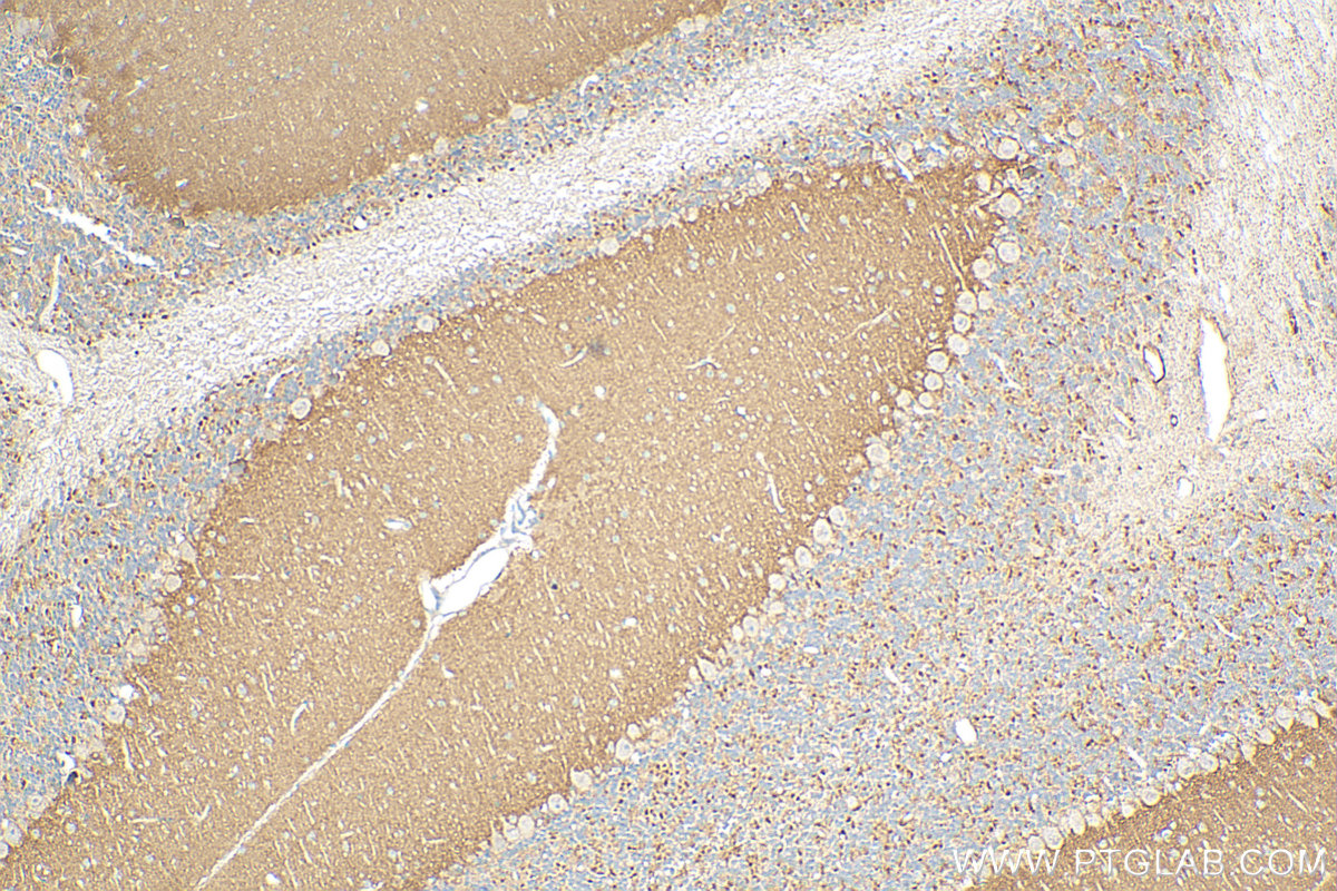 IHC staining of mouse cerebellum using 14156-1-AP