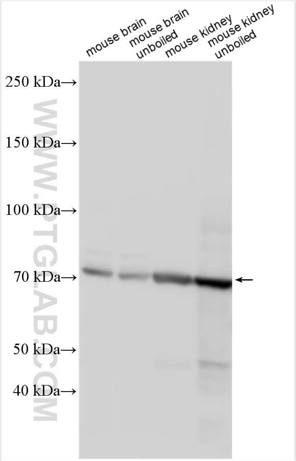 WB analysis using 14156-1-AP