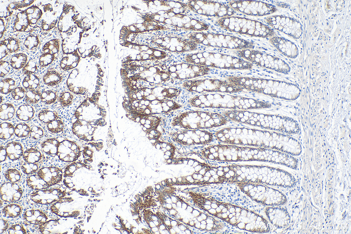 IHC staining of human colon using 27759-1-AP