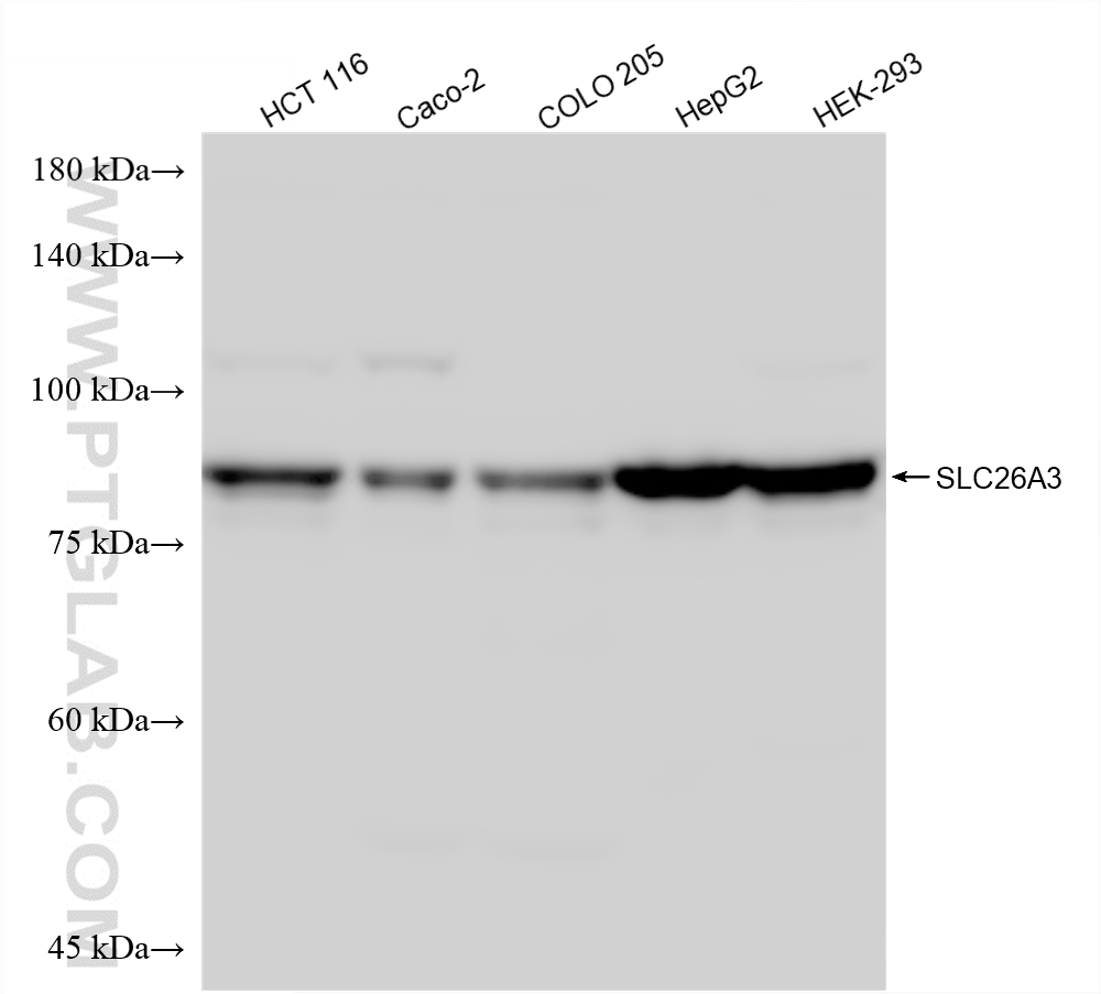 WB analysis using 87216-1-RR (same clone as 87216-1-PBS)