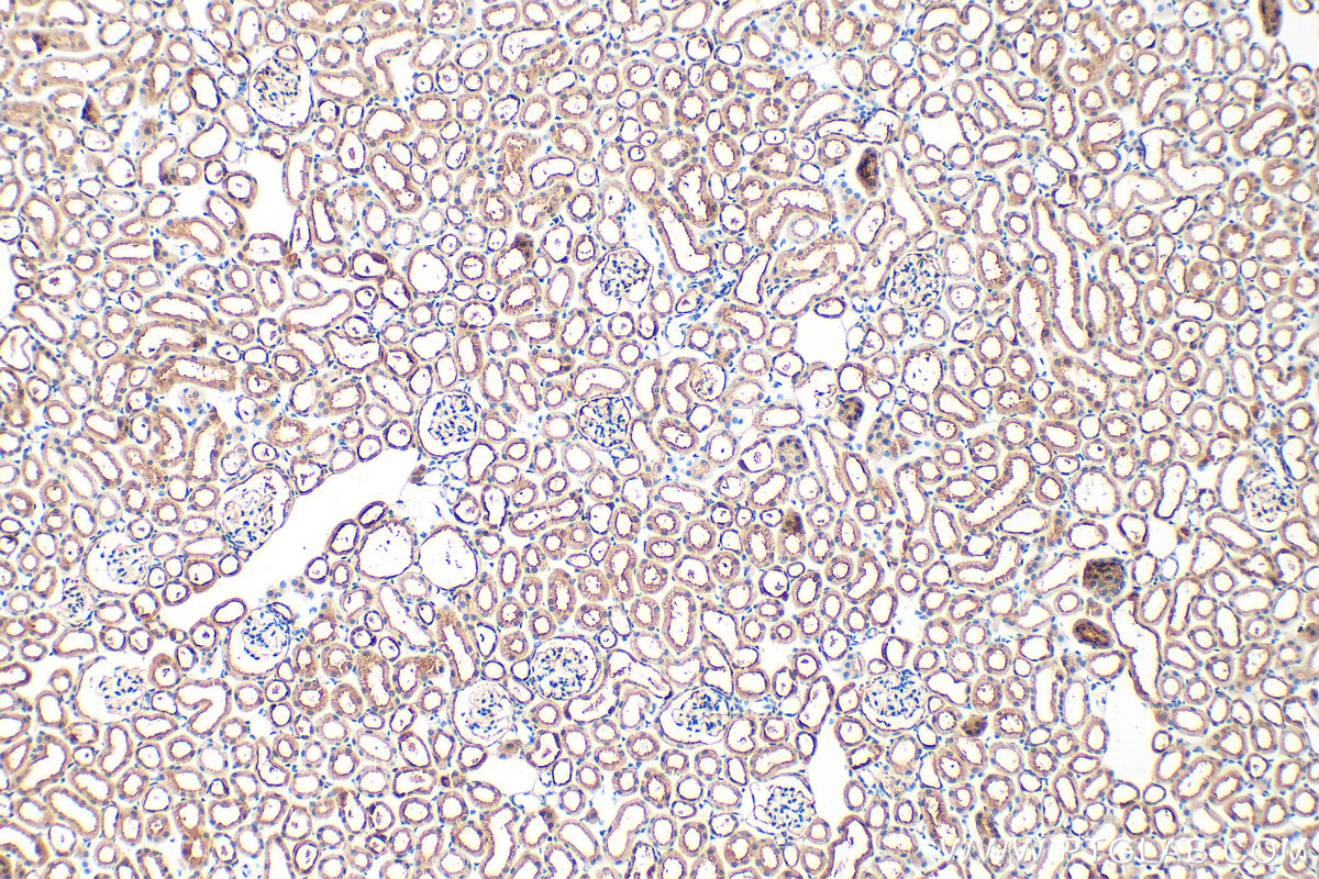 Immunohistochemical analysis of paraffin-embedded mouse kidney tissue slide using 22726-1-AP (SLC26A4 antibody) at dilution of 1:200 (under 10x lens). Heat mediated antigen retrieval with Tris-EDTA buffer (pH 9.0). IHC staining of mouse kidney using 22726-1-AP