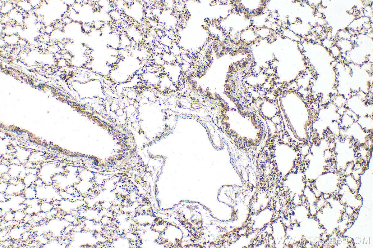 Immunohistochemical analysis of paraffin-embedded mouse lung tissue slide using 22726-1-AP (SLC26A4 antibody) at dilution of 1:200 (under 10x lens). Heat mediated antigen retrieval with Tris-EDTA buffer (pH 9.0). IHC staining of mouse lung using 22726-1-AP