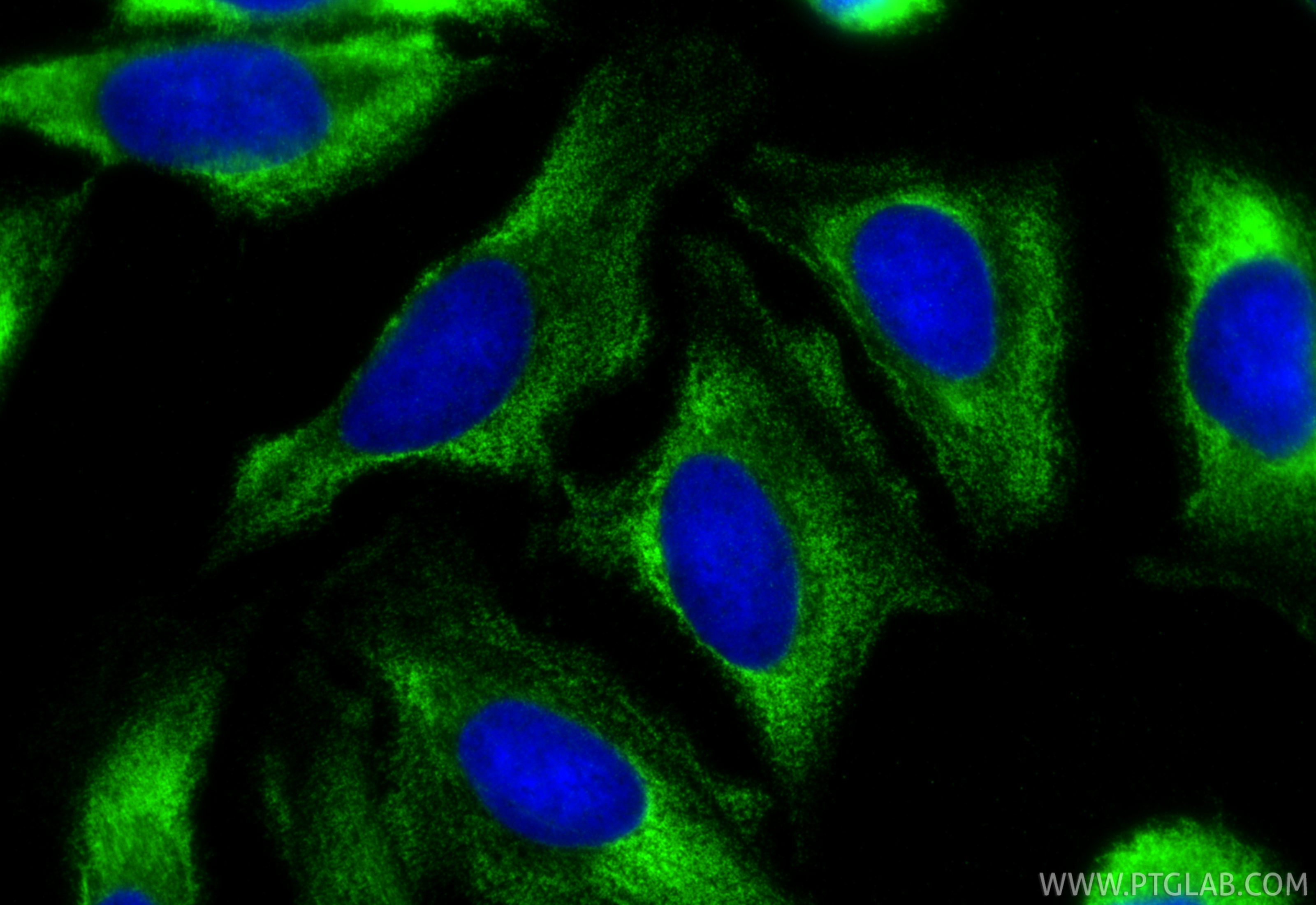 Immunofluorescent analysis of (-20°C Ethanol) fixed U2OS cells using SLC26A7 antibody (<a class='green' href='/productredirect?CatalogNo=17654-1-AP' target='_blank'>17654-1-AP</a>) at dilution of 1:200 and CoraLite®488-Conjugated Goat Anti-Rabbit IgG(H+L) (<a class='green' href='/productredirect?CatalogNo=SA00013-2' target='_blank'>SA00013-2</a>). This data was developed using the same antibody clone with 17654-1-PBS in a different storage buffer formulation. IF Staining of U2OS using 17654-1-AP (same clone as 17654-1-PBS)