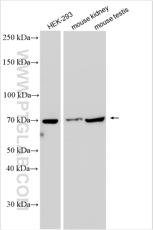 WB analysis using 17654-1-AP