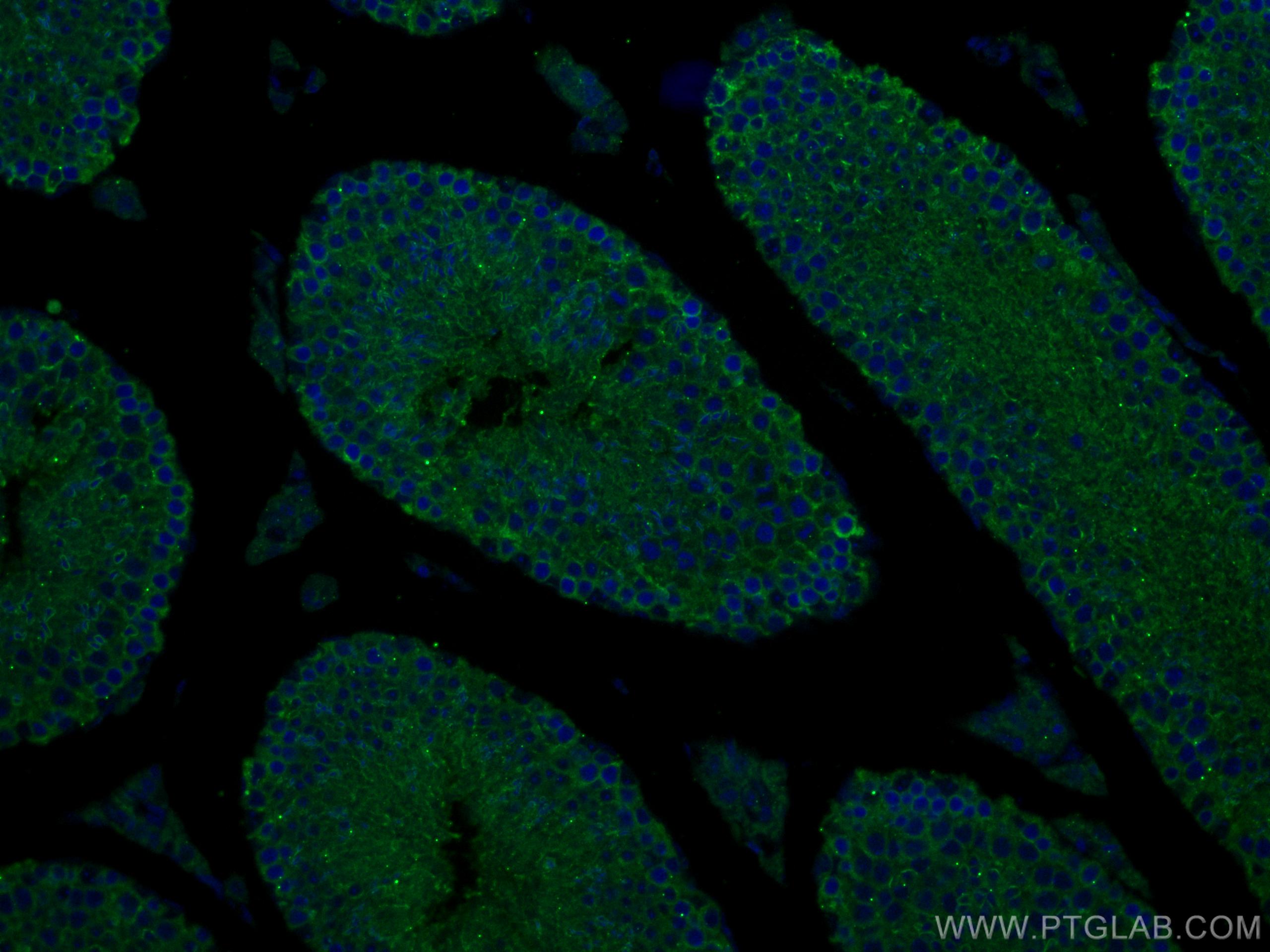 IF Staining of mouse testis using 12776-1-AP