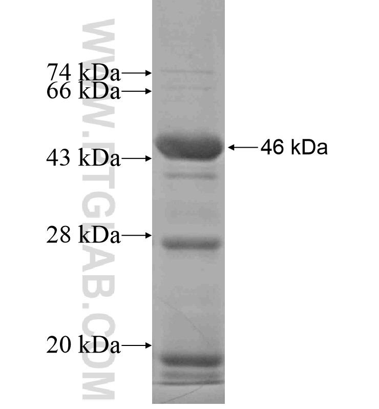 SLC26A9 fusion protein Ag16622 SDS-PAGE SLC26A9 fusion protein Ag16622 SDS-PAGE