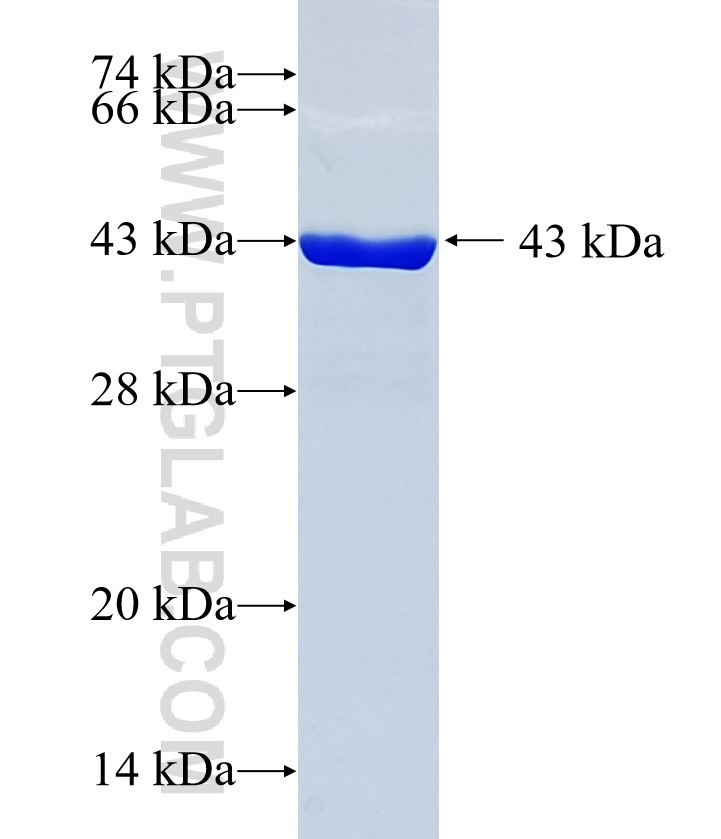 SLC27A1 fusion protein Ag35692 SDS-PAGE SLC27A1 fusion protein Ag35692 SDS-PAGE