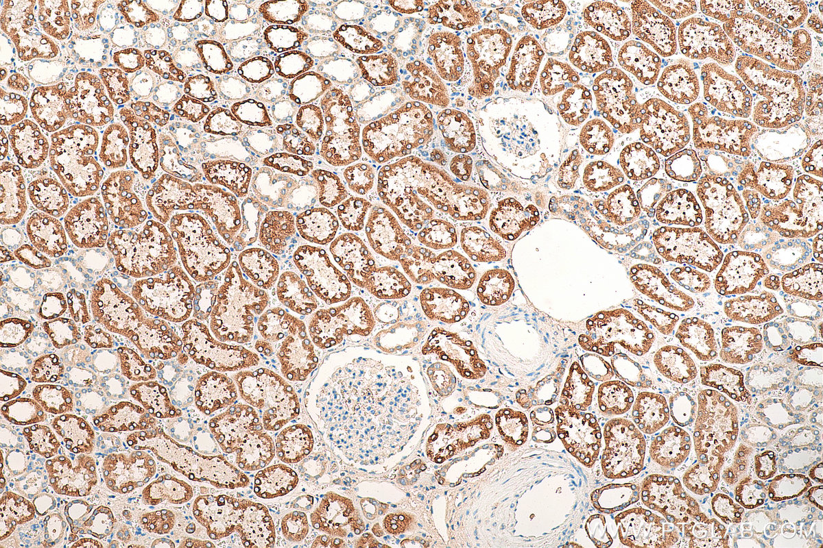 IHC staining of human kidney using 14048-1-AP